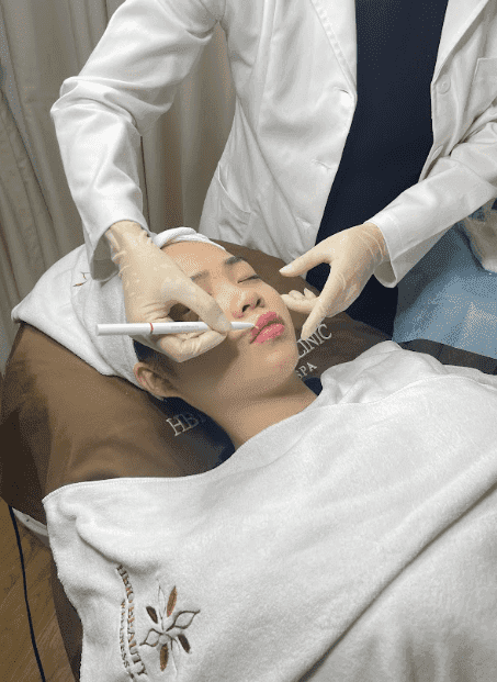 Những trường hợp cần tiêm tan filler môi