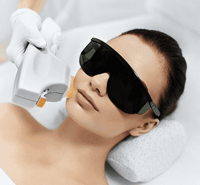 IPL - Xóa sắc tố và tăng đều màu da