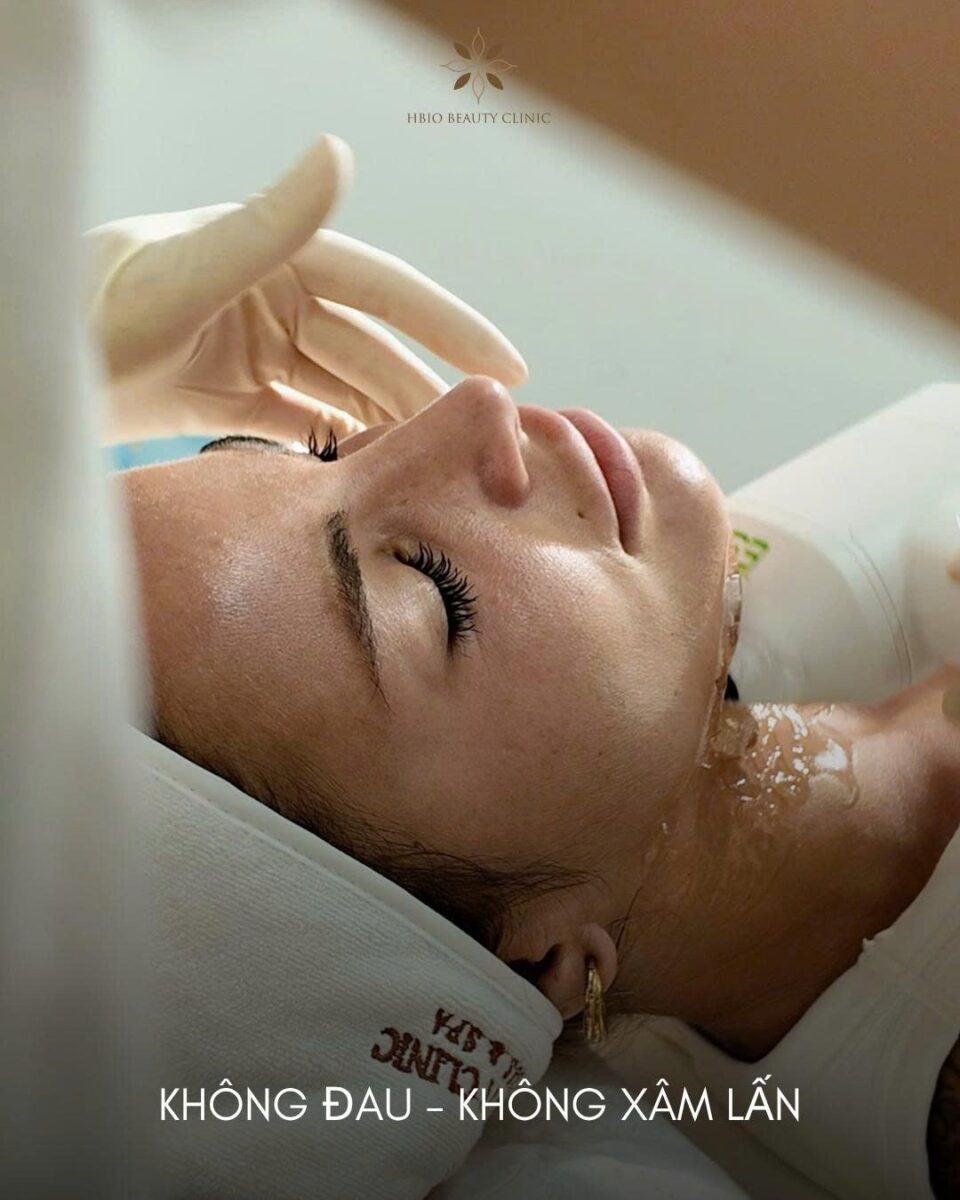 Ai nên thực hiện công nghệ Ultherapy?