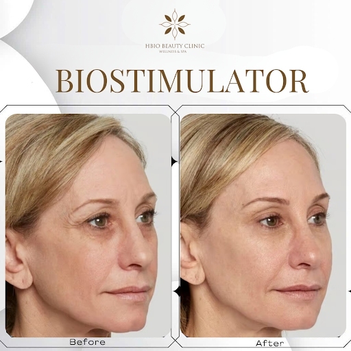 Biostimulator là gì?