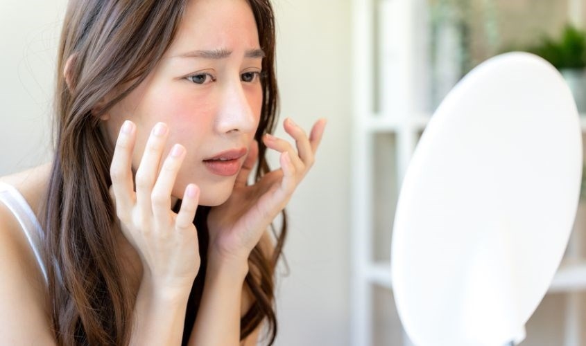 Bôi kem dưỡng ẩm nóng mặt có nên ngưng không