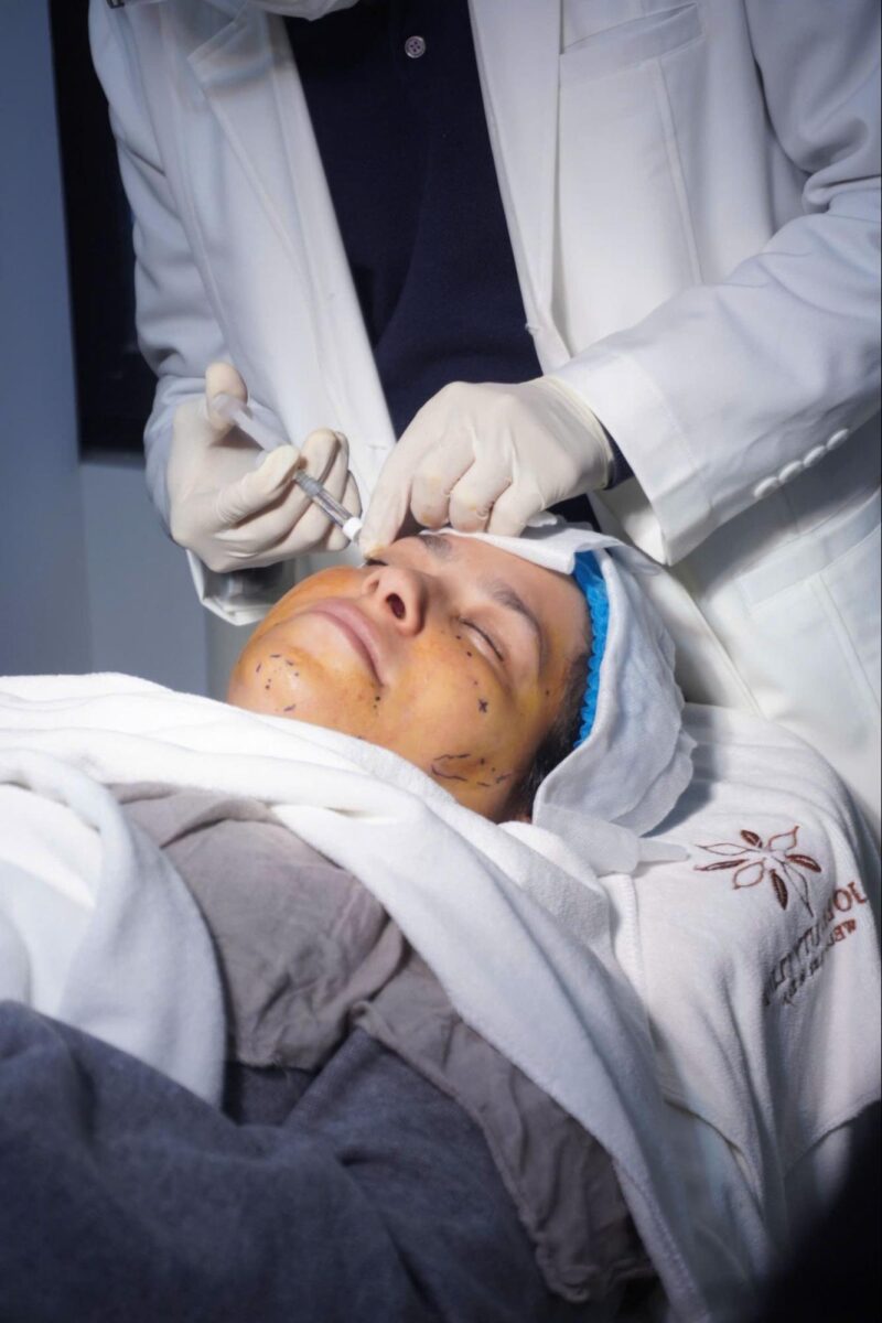 Các phương pháp điều trị sẹo lõm hiệu quả