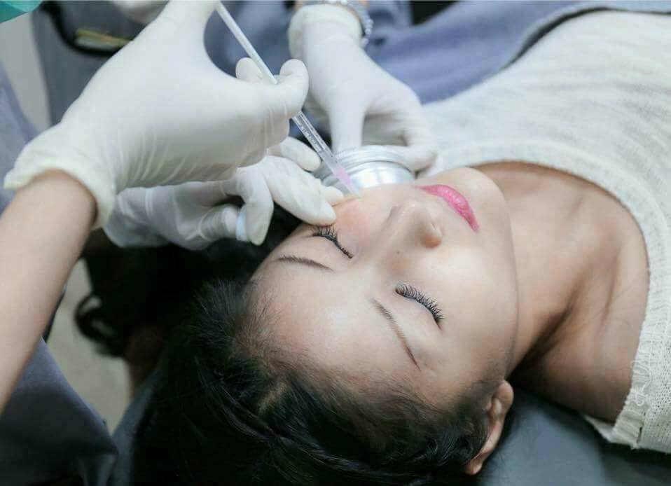 Câu hỏi thường gặp về tiêm Exosome