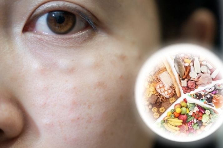 Chăm sóc da sau meso exosome