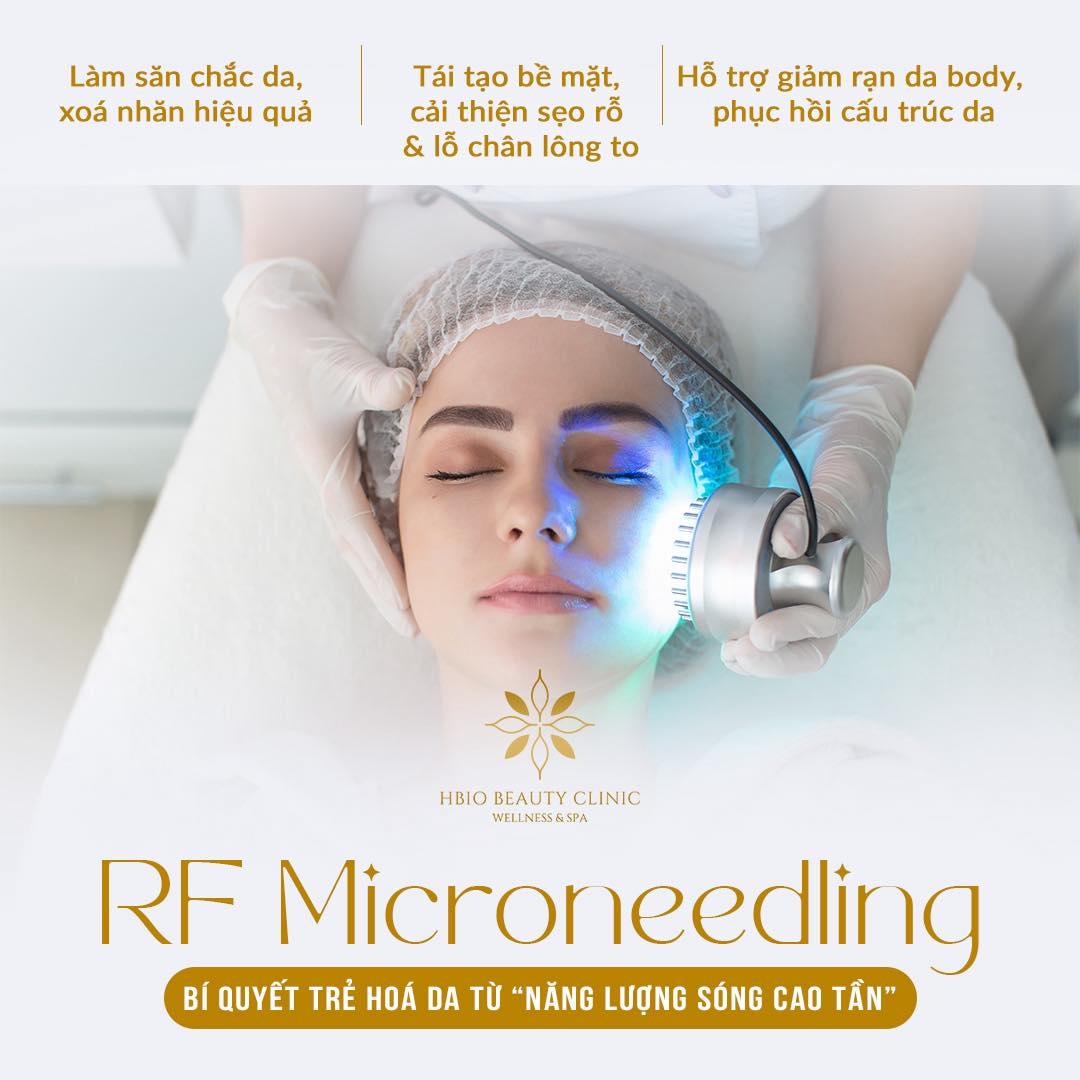 Công nghệ RF (Radio Frequency)