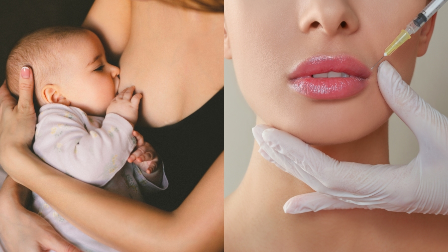 Đang cho con bú tiêm filler có sao không?