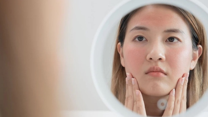 Điều kiện môi trường và thời tiết khiến bôi kem dưỡng da bị nóng mặt