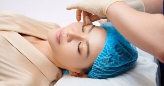 Do đặc điểm cơ địa khiến căng chỉ bị lồi lõm