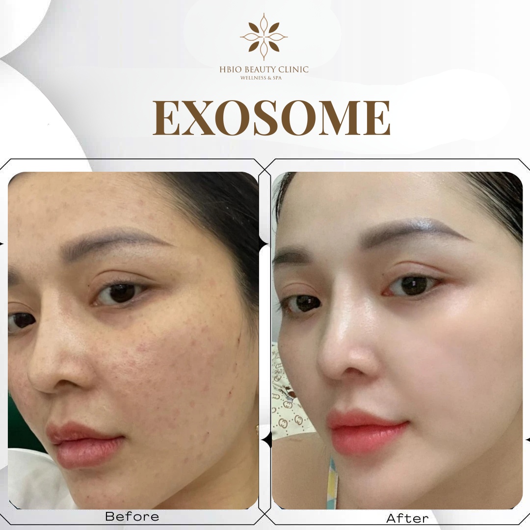 Làn da bước vào giai đoạn tái tạo và phục hồi mạnh mẽ