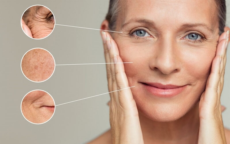 Công nghệ Ultherapy