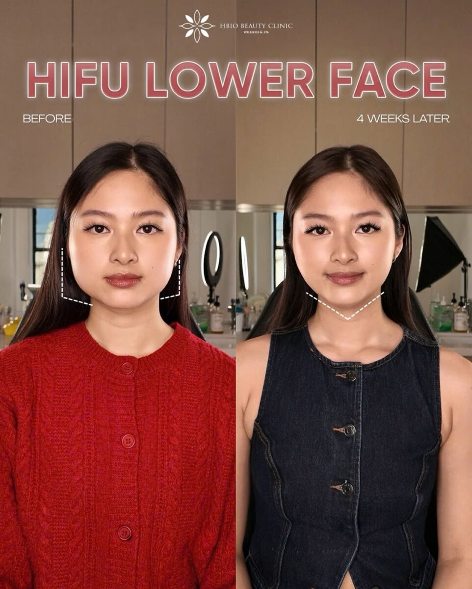 Lưu ý khi lựa chọn phương pháp trẻ hóa da