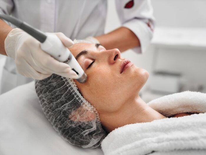 Meso không kim là gì và cơ chế hoạt động