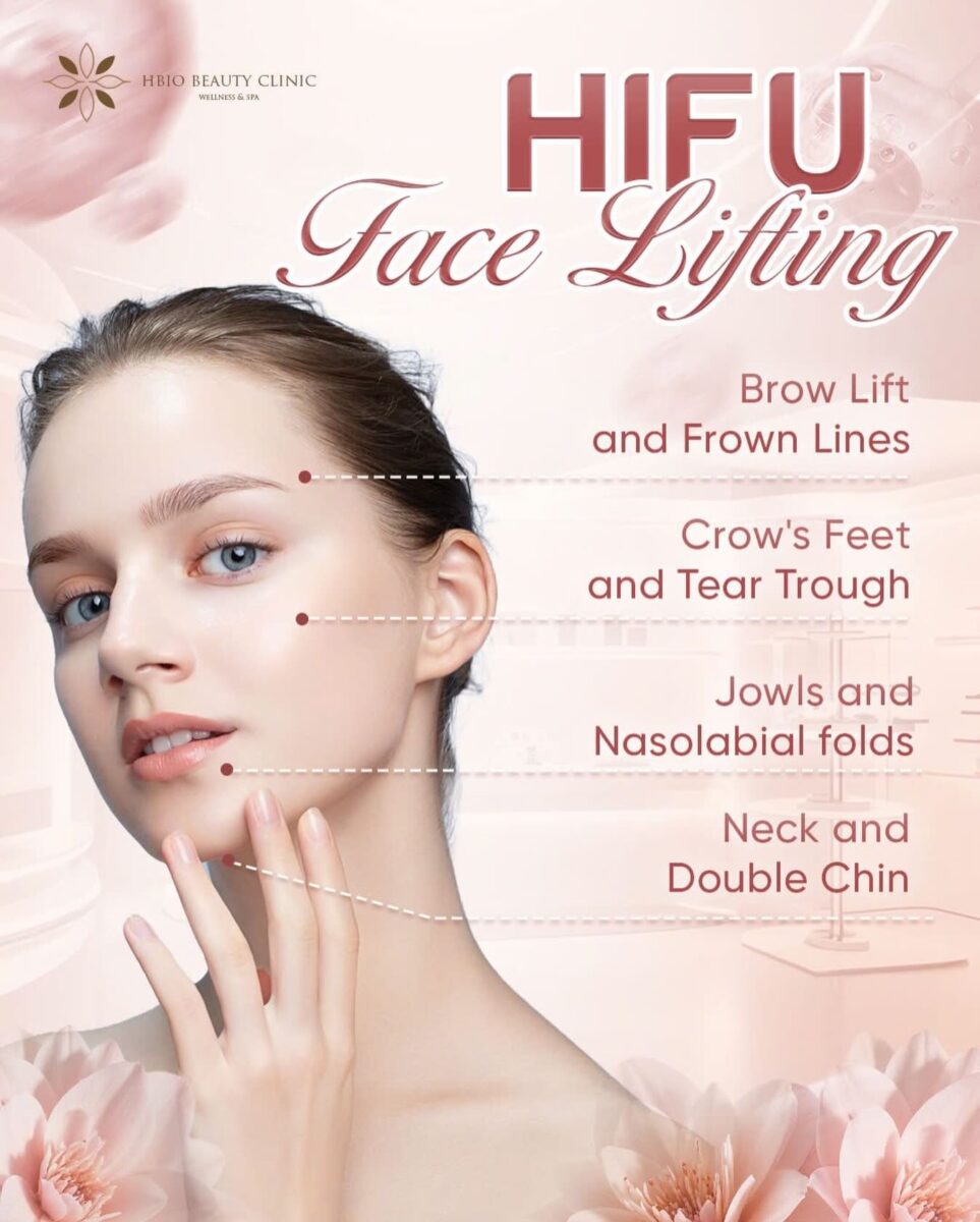 Nâng cơ bằng công nghệ HIFU