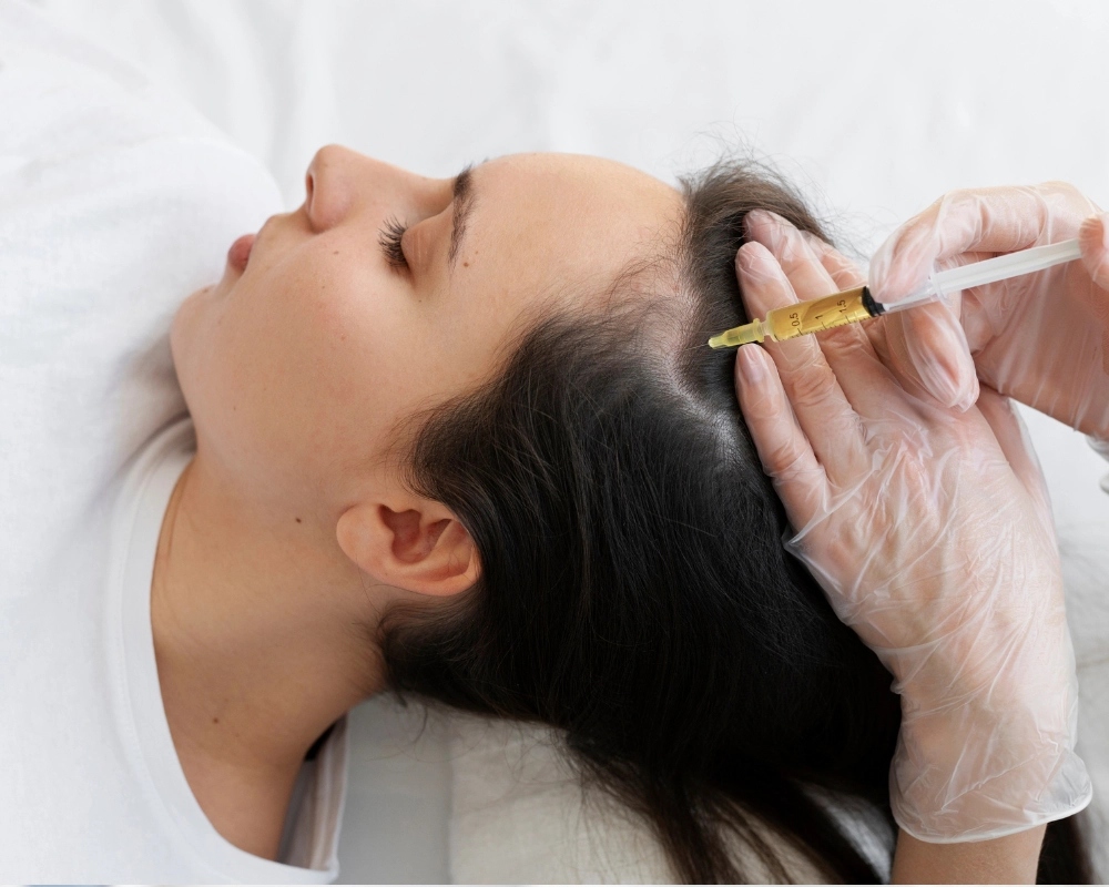 Quy trình tiêm PRP điều trị rụng tóc tại Hbio Clinic