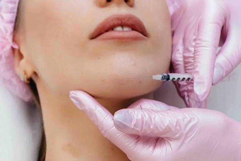 Sau sinh 6-12 tháng thì có thể tiêm filler