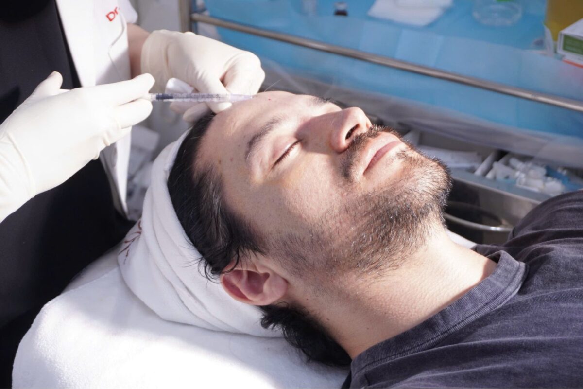 Tiêm chất kích thích tăng sinh collagen