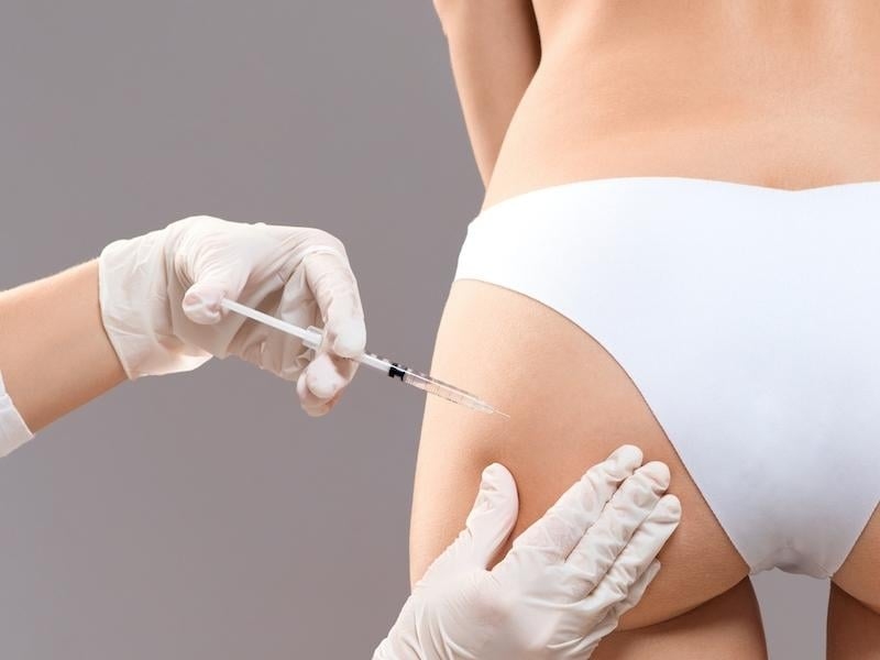 Tiêm filler mông có đau không?