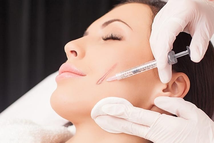 Ưu điểm của phương pháp tiêm tan sẹo