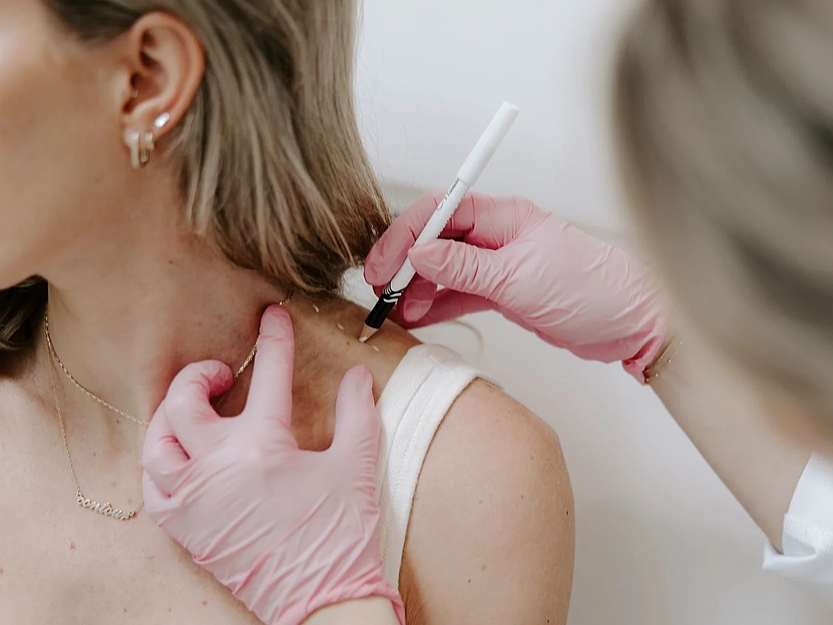 Ưu và nhược điểm của tiêm botox vai