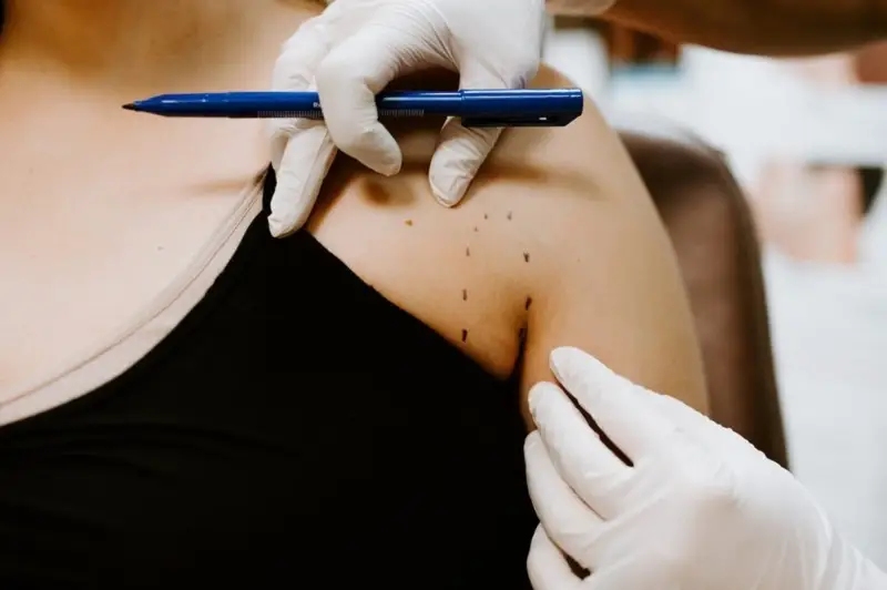 Ưu và nhược điểm của tiêm tan mỡ vùng nách