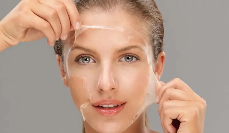Các cấp độ của peel da