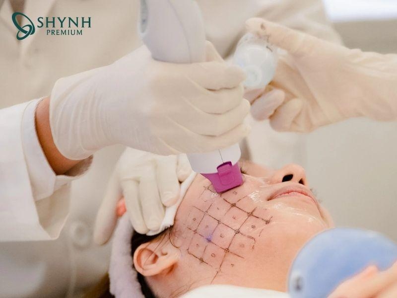 Các yếu tố quyết định thermage flx giữ được bao lâu
