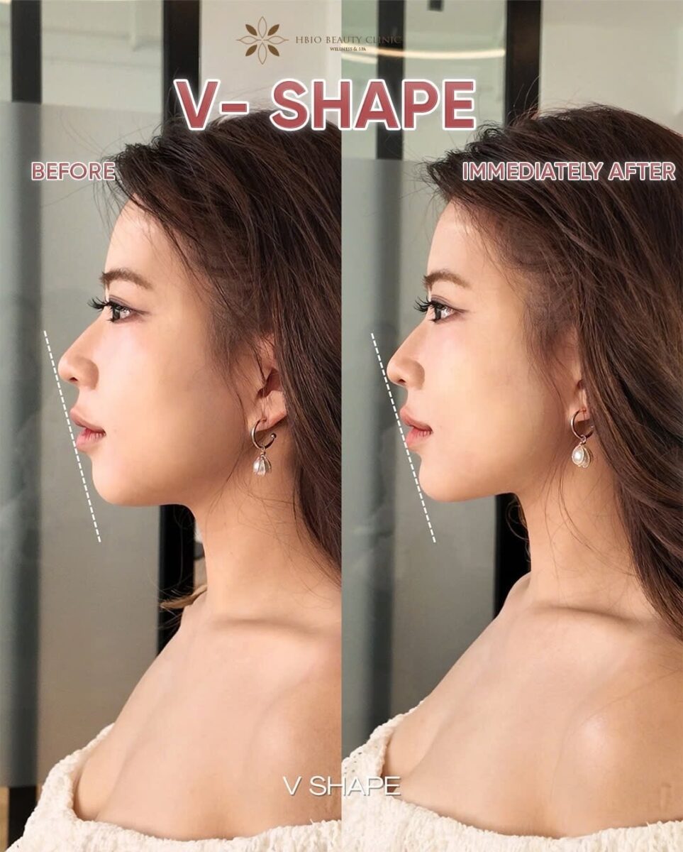 Hiệu quả tuyệt đối