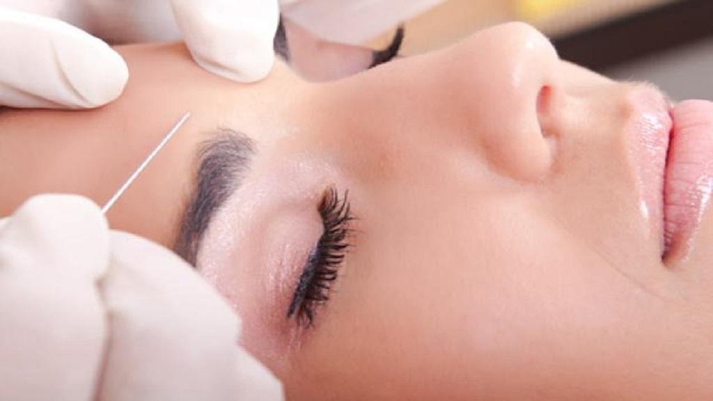 Những lưu ý sau khi thực hiện nâng chân mày bằng chỉ