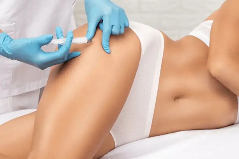Những lưu ý "sống còn" khi tiêm filler mông để đảm bảo an toàn