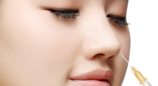 Quy trình chỉnh lệch nhân trung chuẩn y khoa