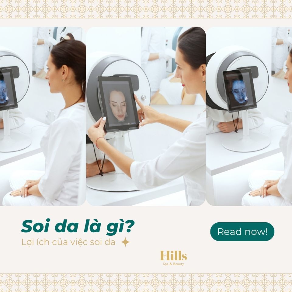 Soi da là gì và cơ chế hoạt động chuyên sâu