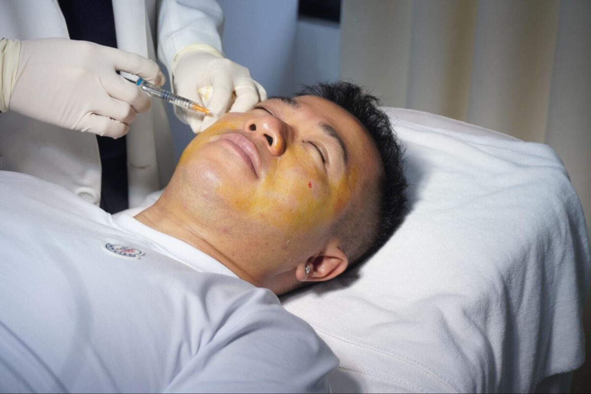 Cách khắc phục tiêm filler bị chảy xệ hiệu quả