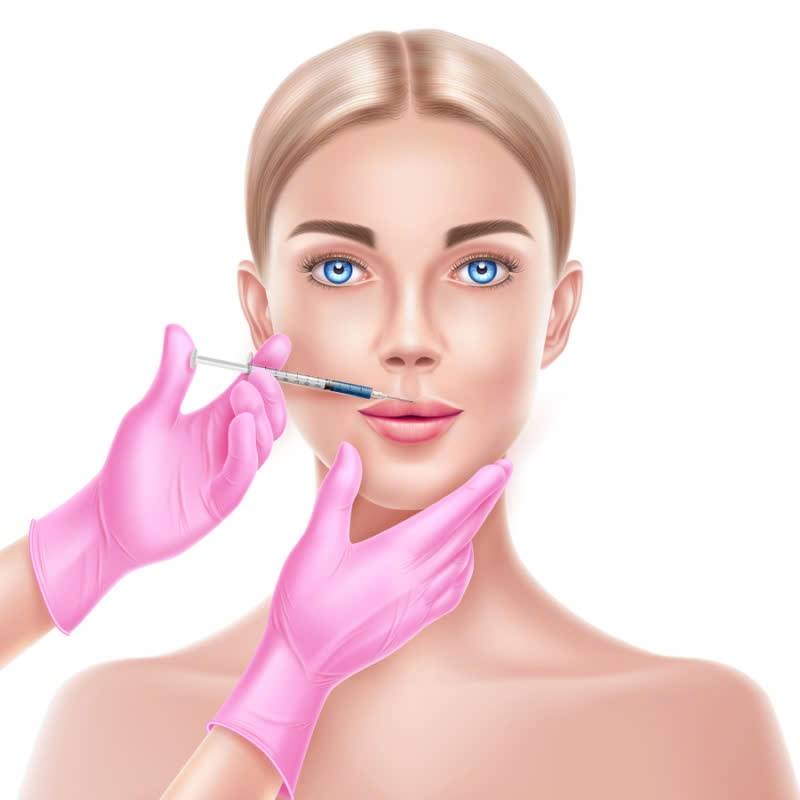 Tiêm Filler tạo hình nhân trung