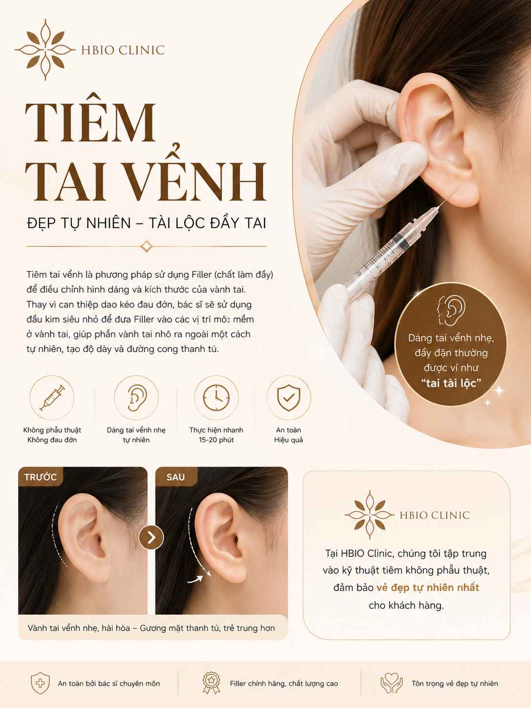 Tiêm tai vểnh là gì? 