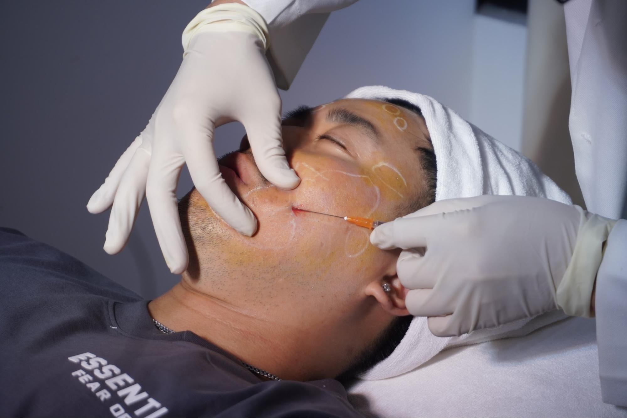 Sử dụng filler chính hãng để đảm bảo an toàn cho làn da