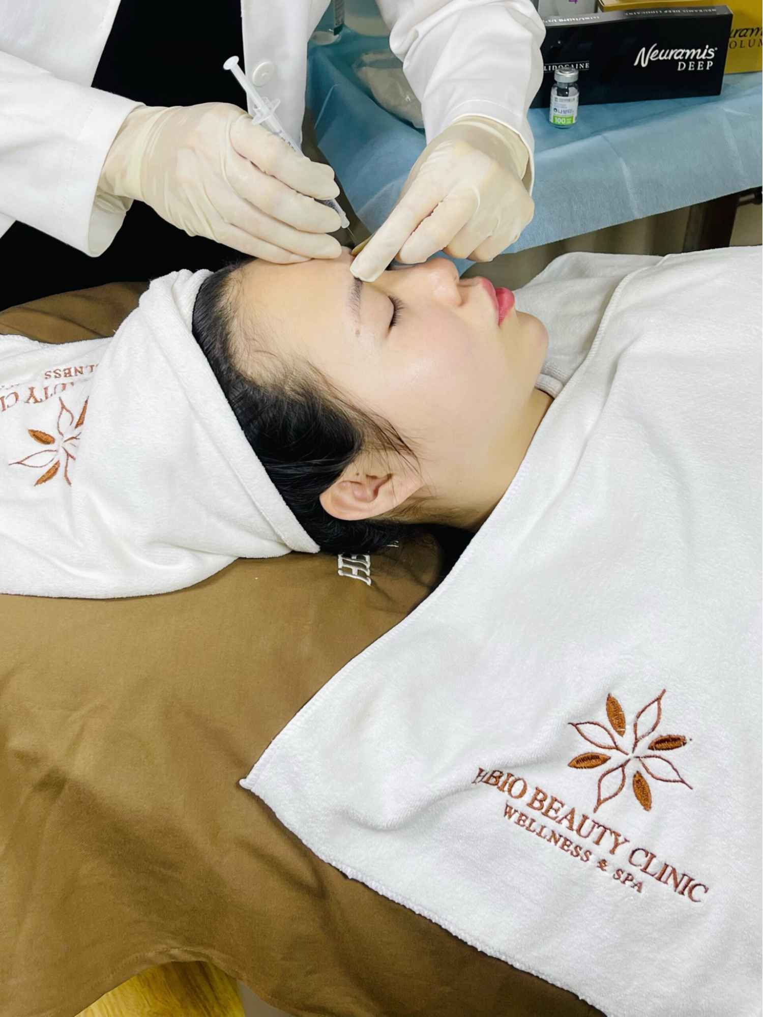 Ưu điểm khi thực hiện căng chỉ mắt cáo tại HBIO Clinic
