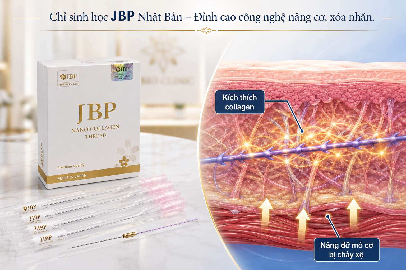 Chỉ JBP