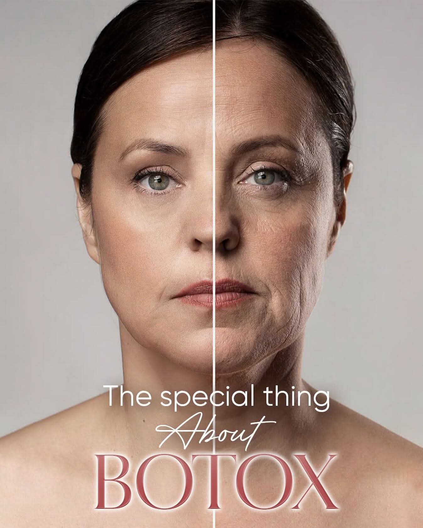 Tiêm Botox gọn hàm