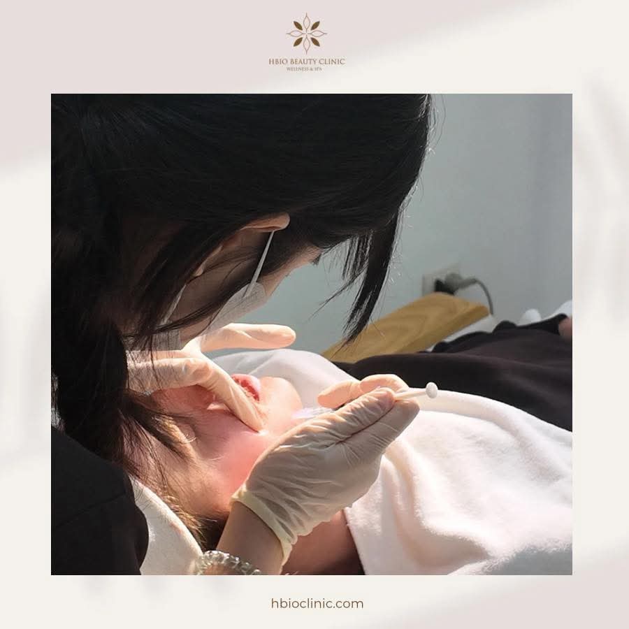 Địa chỉ tiêm filler mặt lệch uy tín hàng đầu