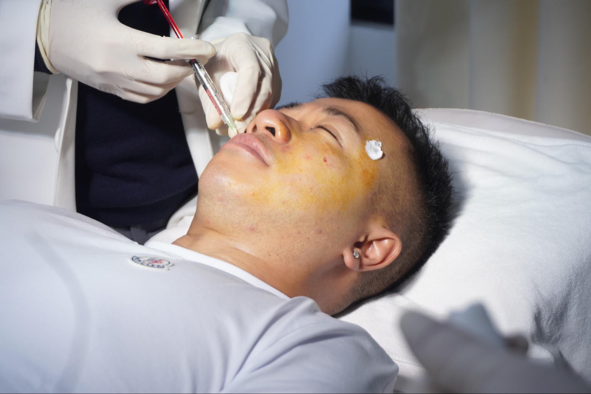 Bác sĩ trực tiếp thực hiện liệu trình tiêm filler môi