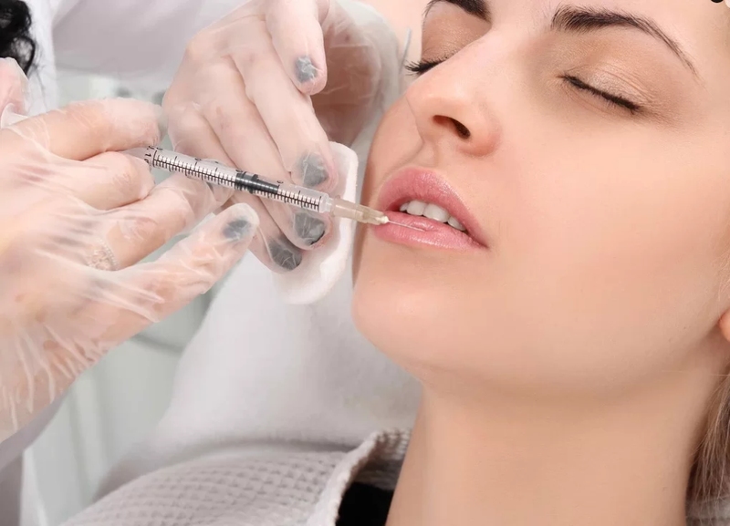 Tiêm filler môi có ảnh hưởng gì không?