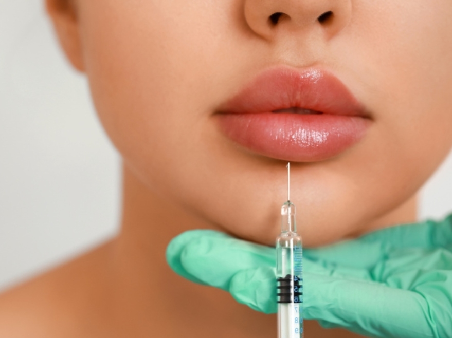 Tiêm filler môi có hôn được không?