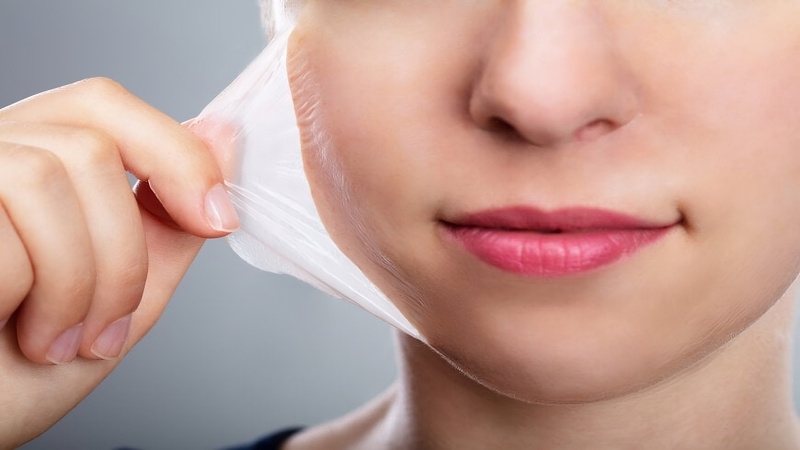 Trường hợp nào mụn viêm có thể peel da