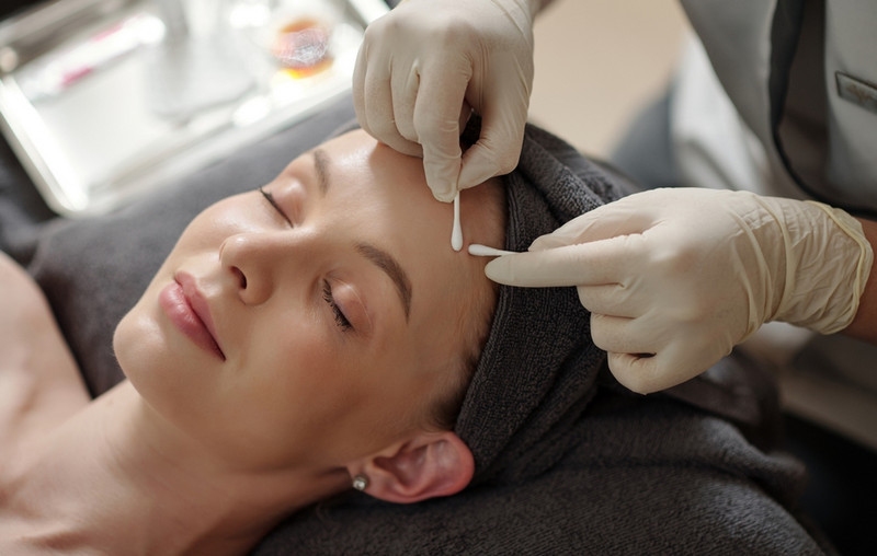 Lợi ích khi nặn mụn tại spa