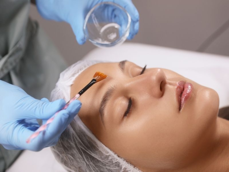 Bao lâu sau peel thì được dùng lại retinol