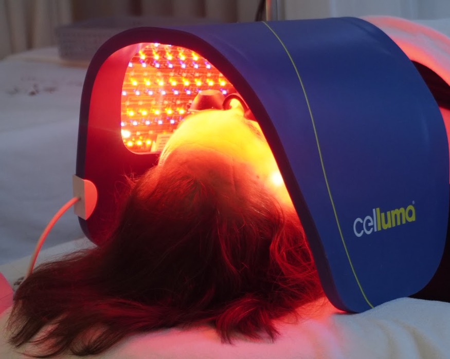 Chiếu ánh sáng điều trị mụn 