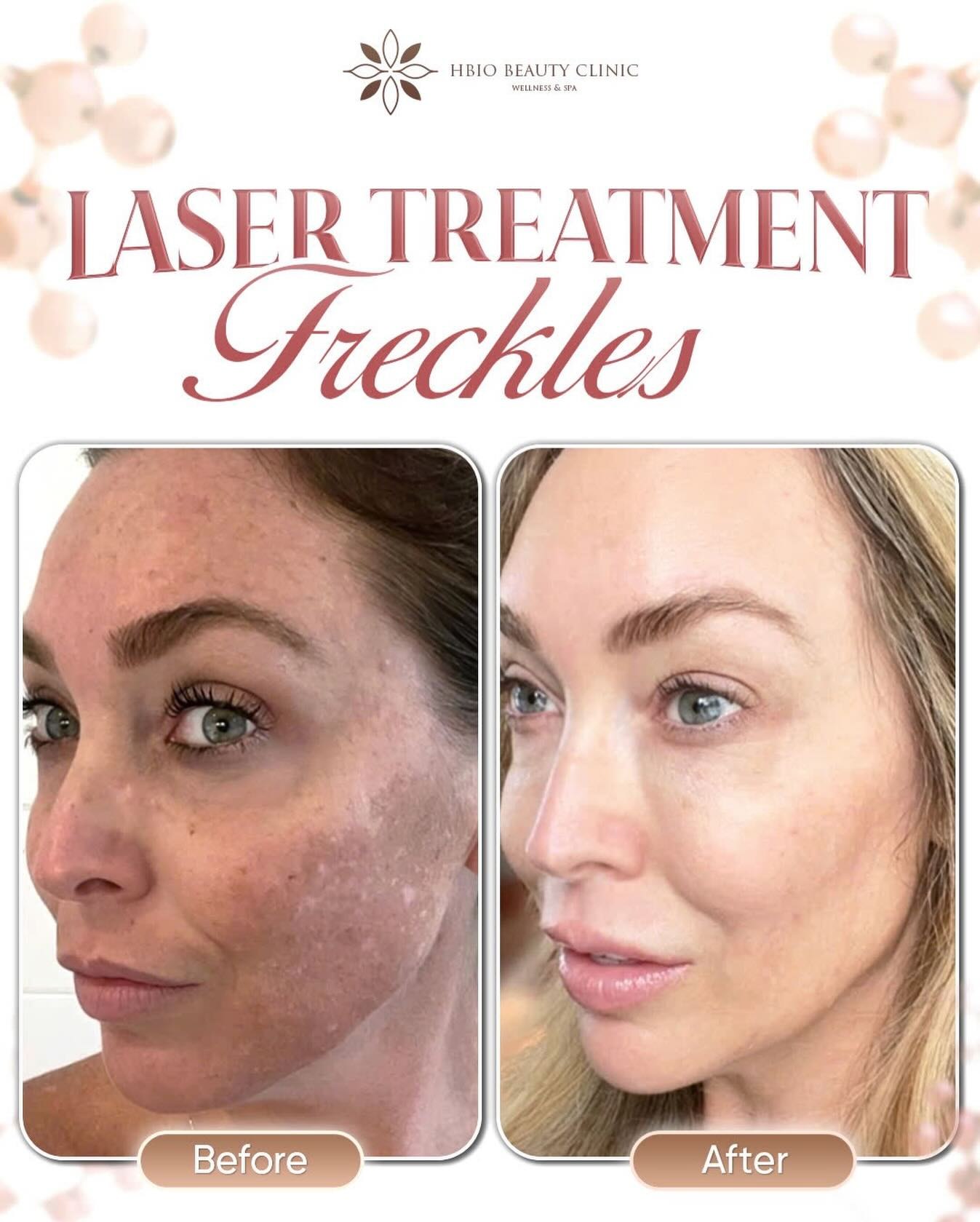 Laser và công nghệ ánh sáng