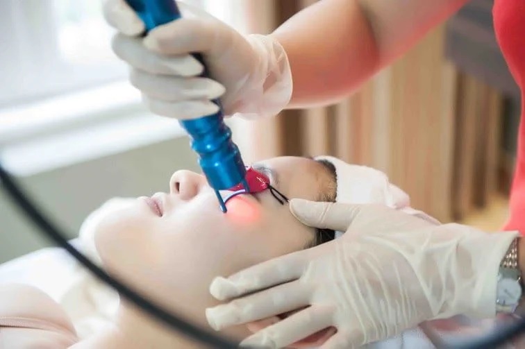 Pre-laser considerations
