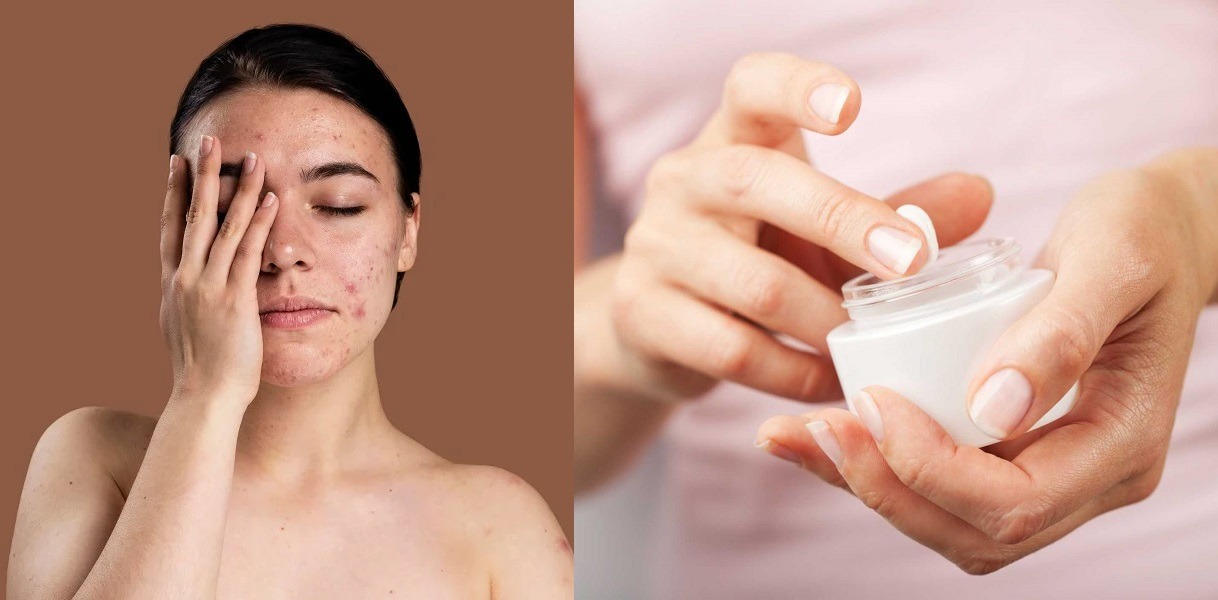 Ngưng sử dụng các sản phẩm chứa hoạt chất độc hại