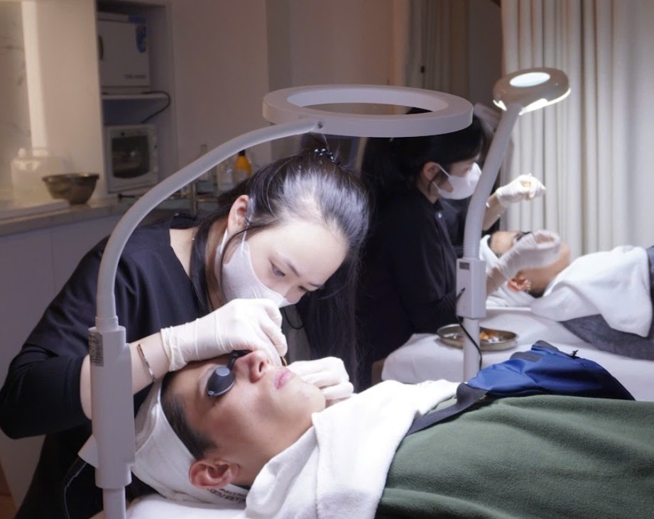 Acne extraction for breakouts around the mouth at HBIO Clinic
